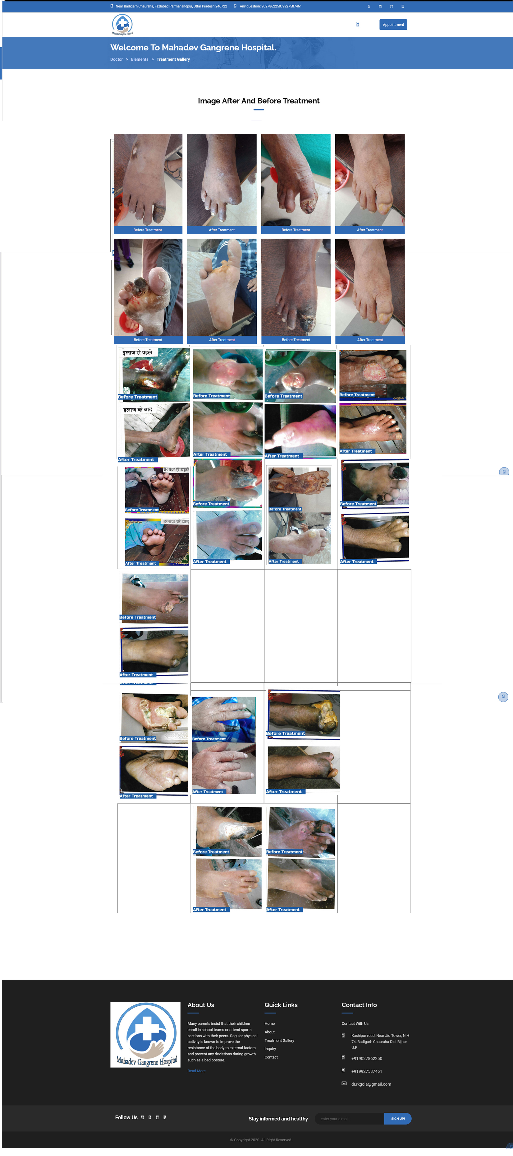 Treatment Gallery